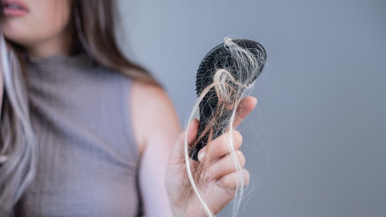 Telogen Effluvium: Ani Saç Dökülmesi